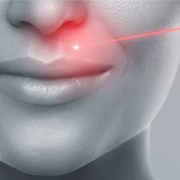 Is-Laser-hair-removal-safe