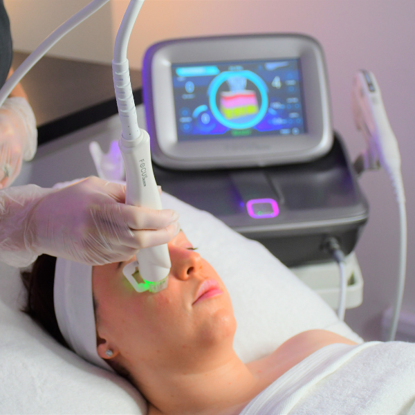 RF-Microneedling